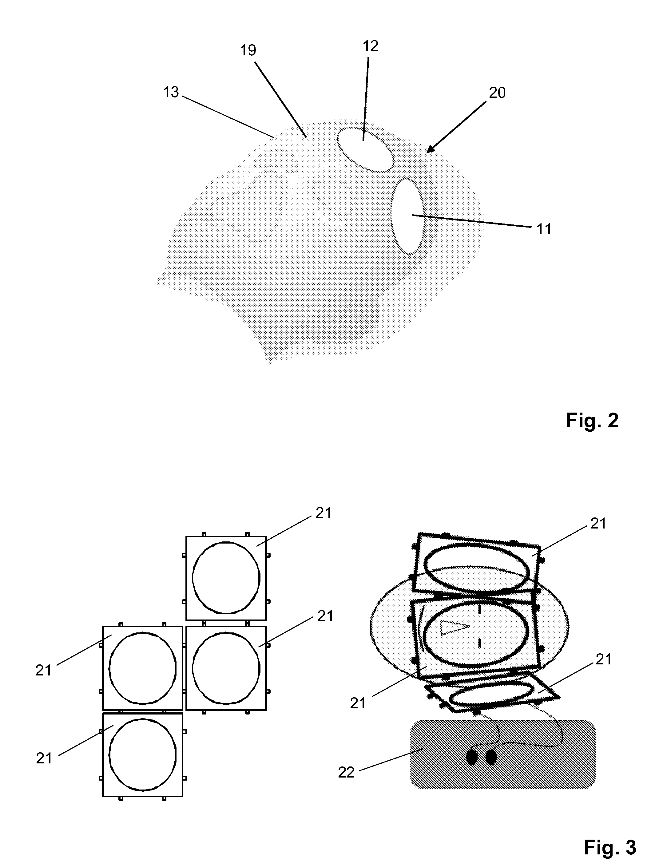 Method of producing personalized RF coil array for MR imaging guided interventions