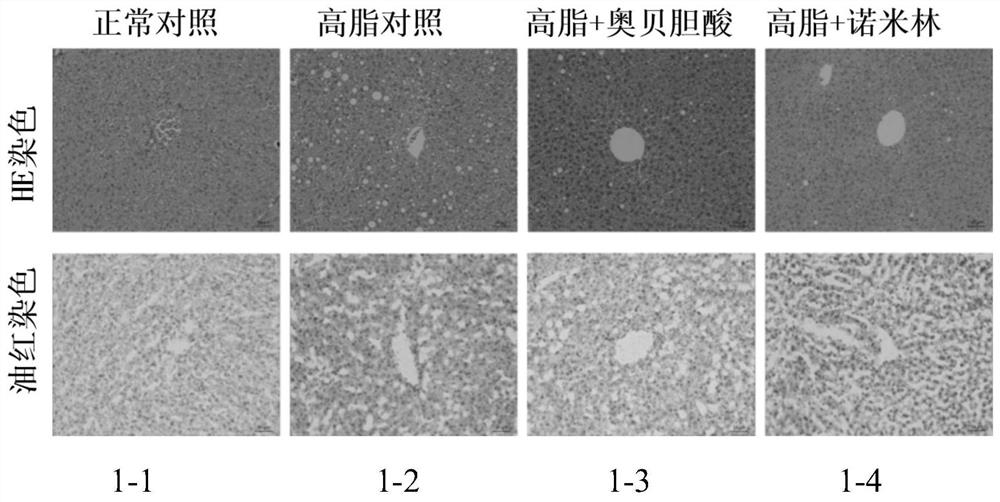 Application of Nomilin in Preparation of Drugs for Improving Liver Damage Caused by Cholestasis and Metabolic Diseases
