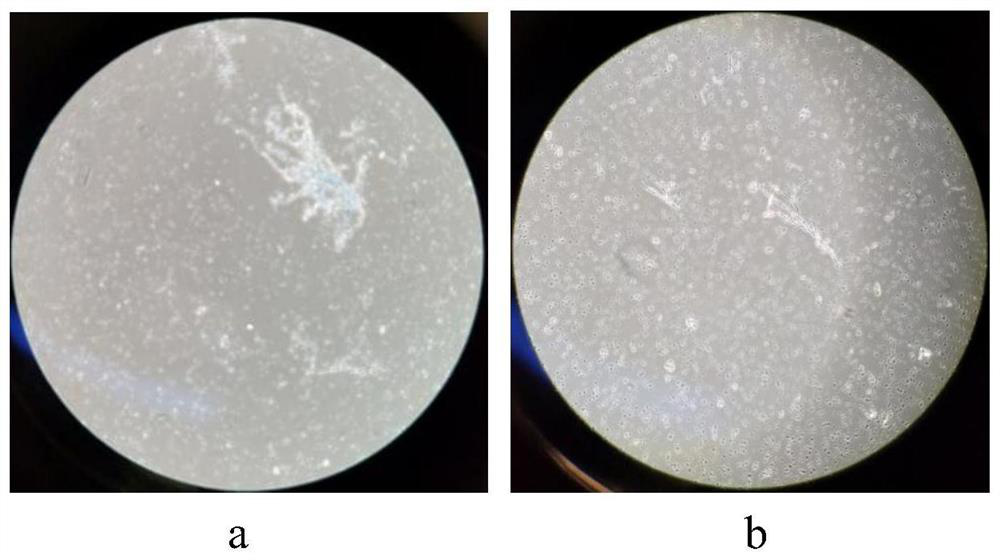 A method for separating and purifying cerebral microvessels