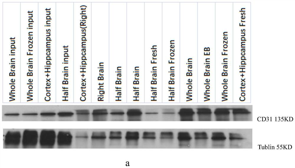 A method for separating and purifying cerebral microvessels