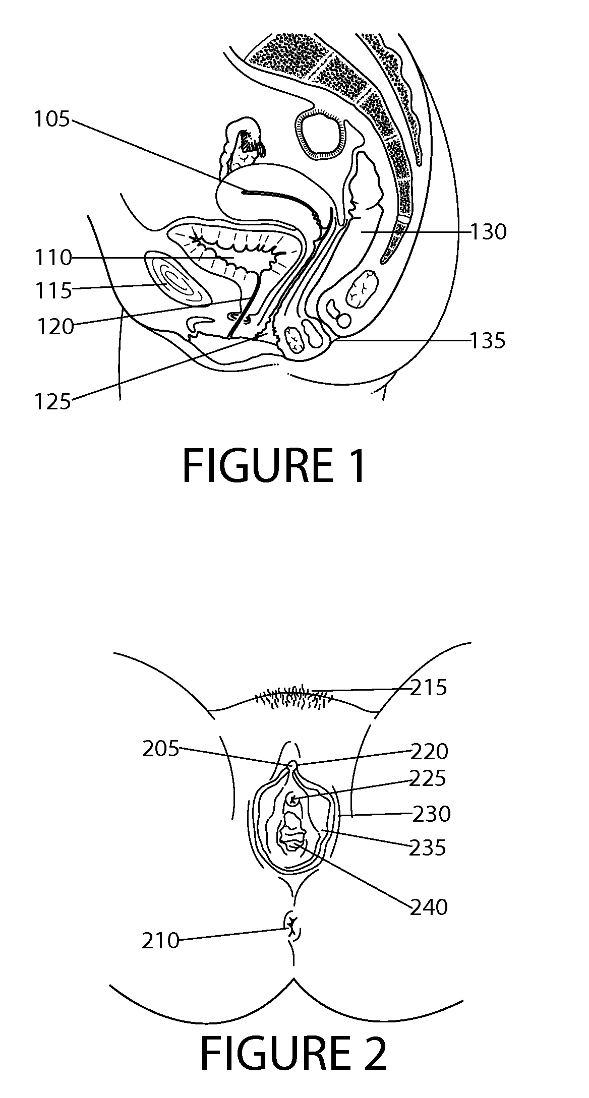 Surgical devices and method for vaginal prolapse repair