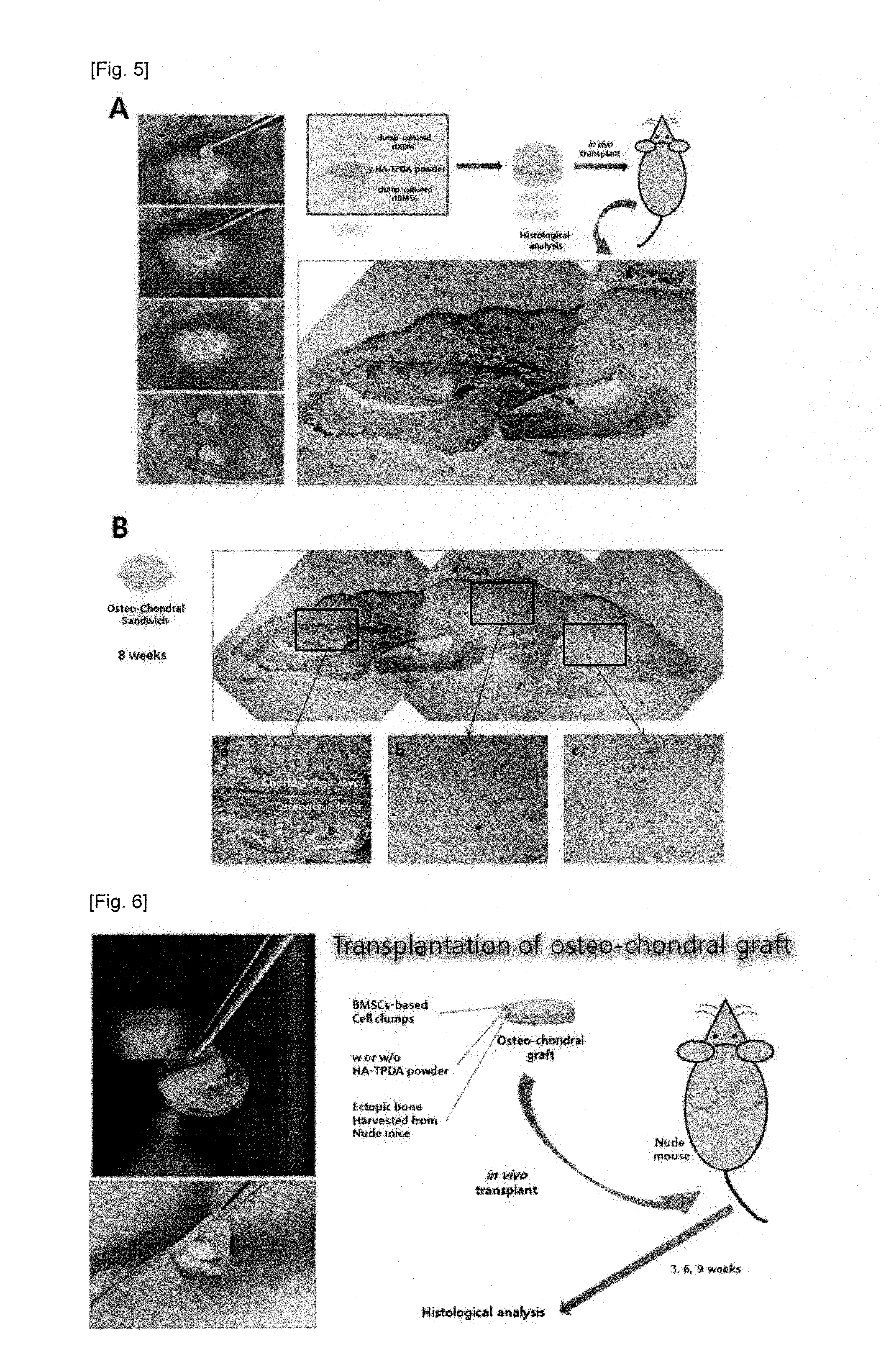 Bio-adhesive agent comprising surface-modified hydroxyapatite and use thereof