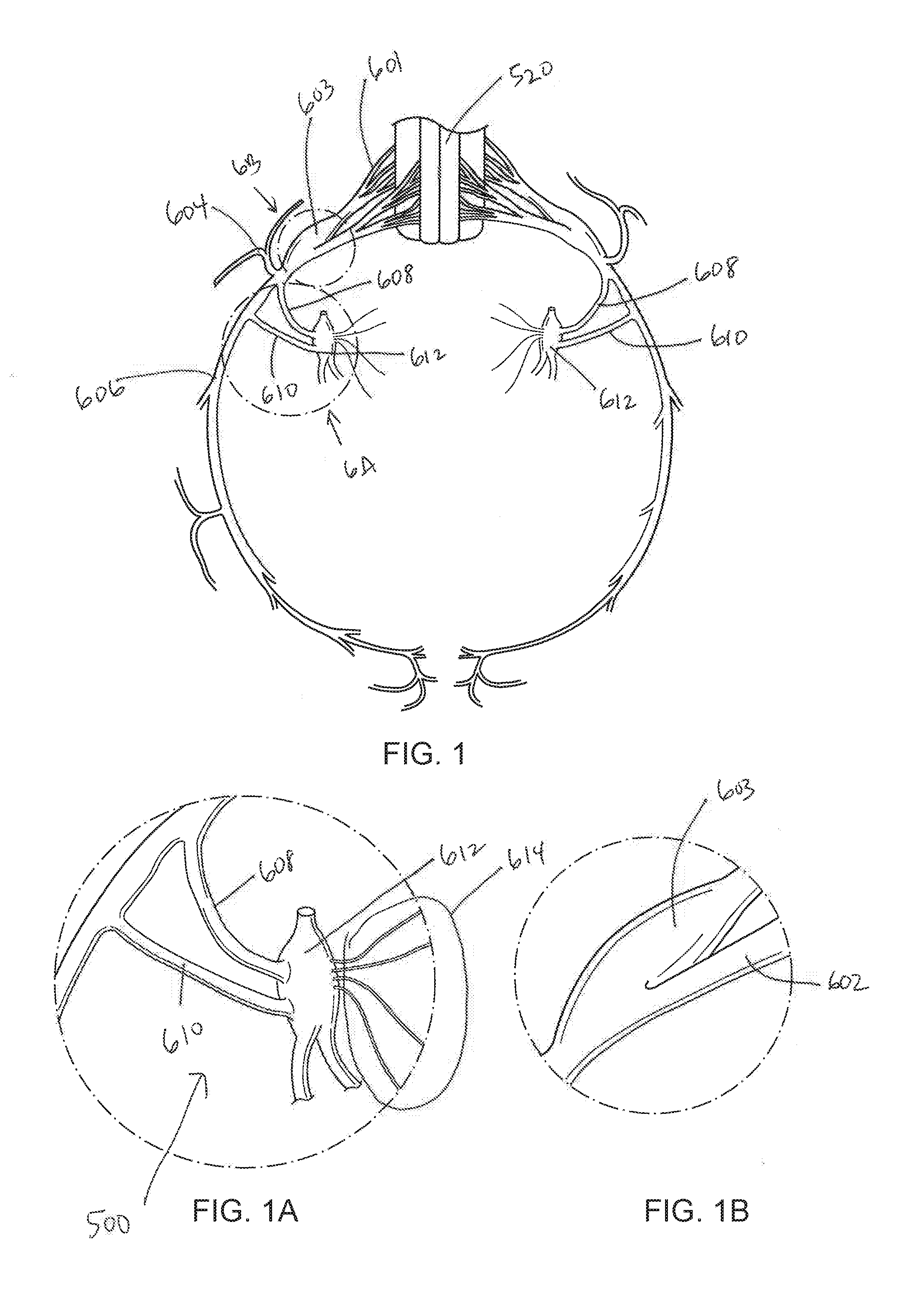 Systems and methods for sympathetic cardiopulmonary neuromodulation