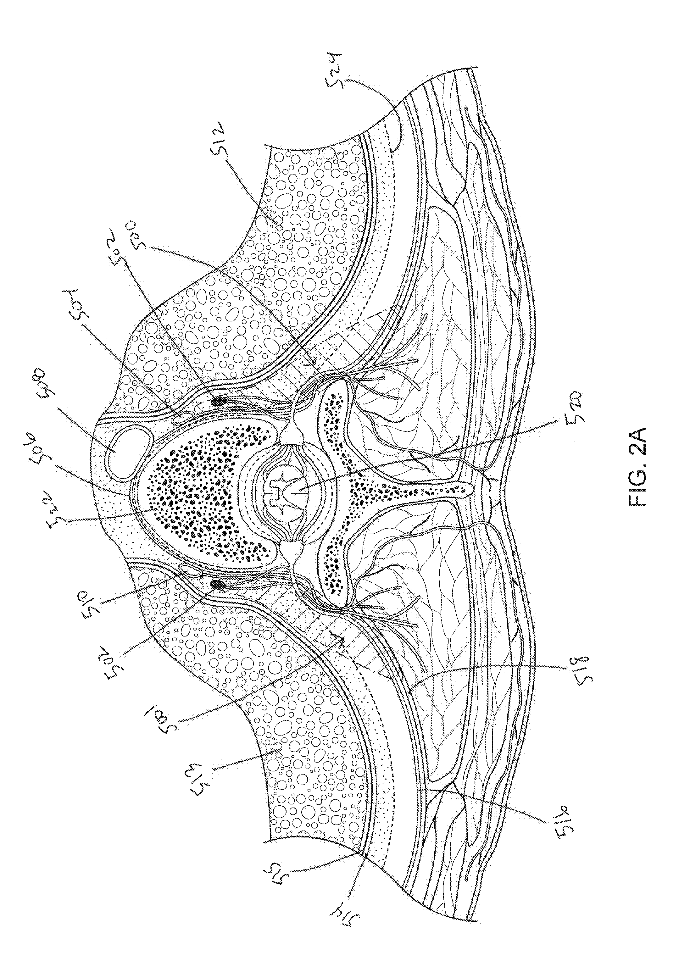 Systems and methods for sympathetic cardiopulmonary neuromodulation