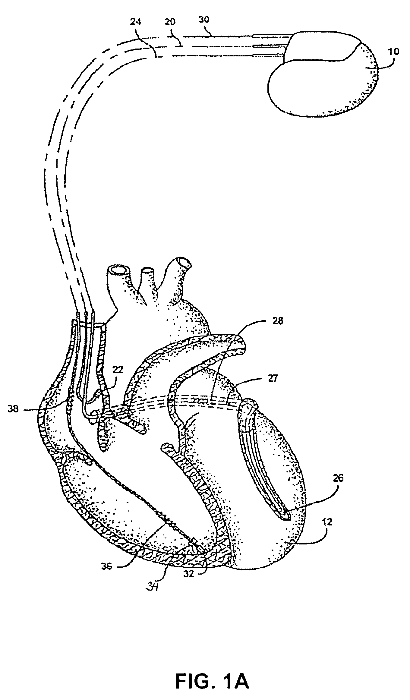 Methods and devices for determining exercise diagnostic parameters