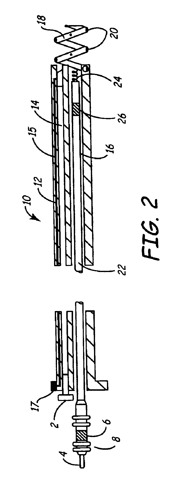 Delivery of active fixation implatable lead systems
