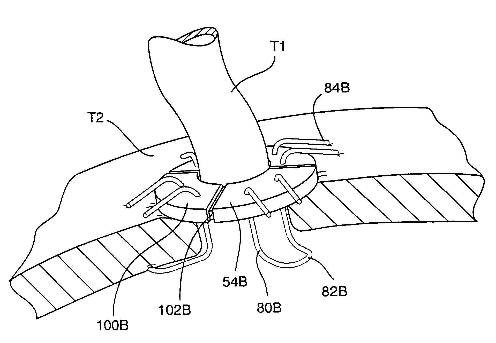System for performing vascular anastomoses