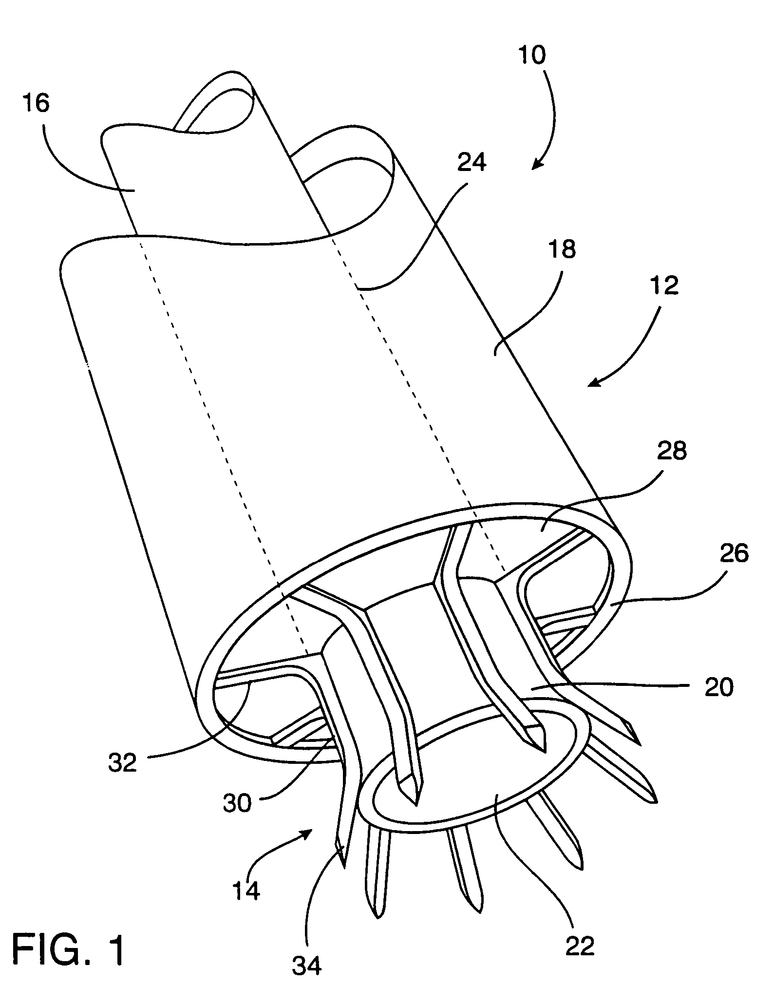 System for performing vascular anastomoses