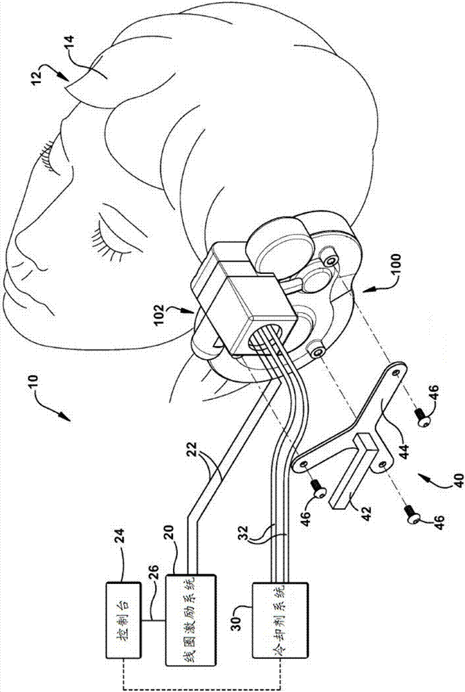 Deep nerve stimulator