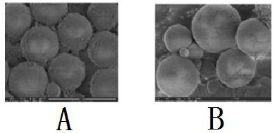 Double-layer microspheres loaded with parecoxib, interleukin-4 and bovine serum albumin and used for treating osteoarthritis and preparation method of double-layer microspheres