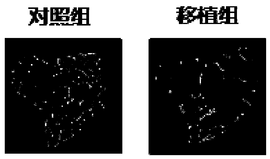 Method for constructing model of mouse of osteoporosis caused by secondary hyperparathyroidism and application of method