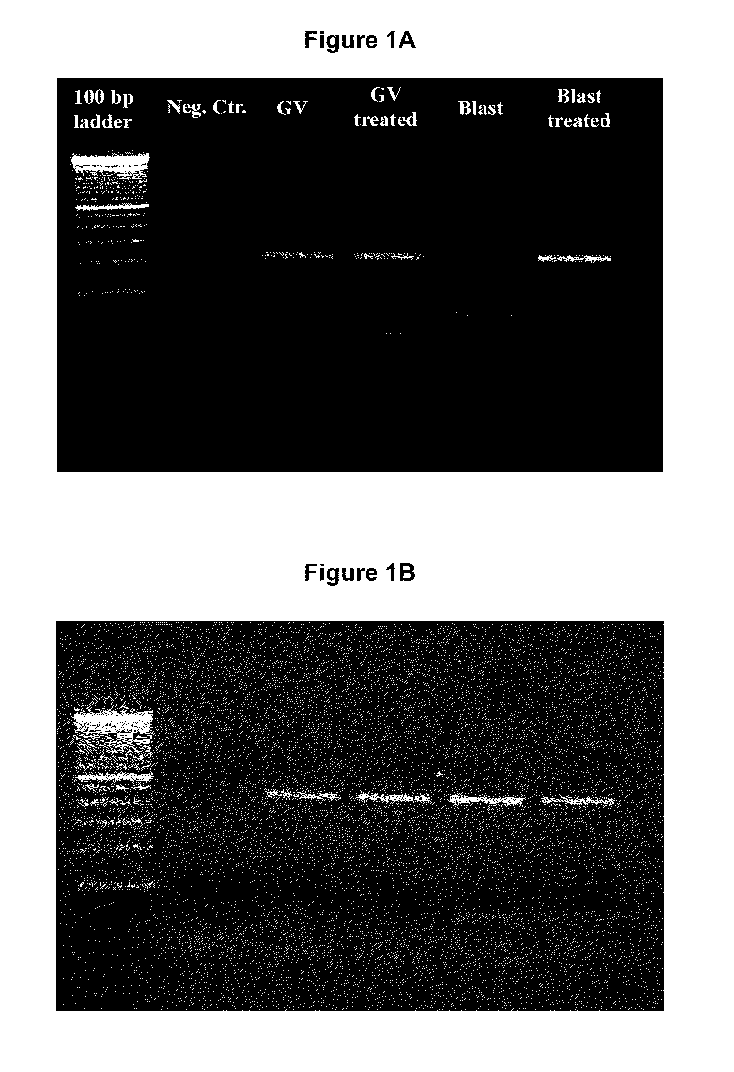 Embryo culture media containing thyroid hormone