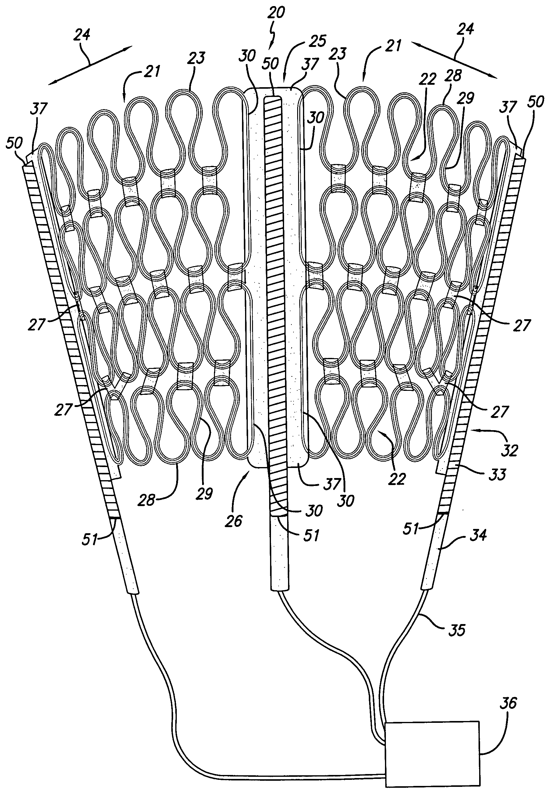 Cardiac harness for treating congestive heart failure and for defibrillating and/or pacing/sensing