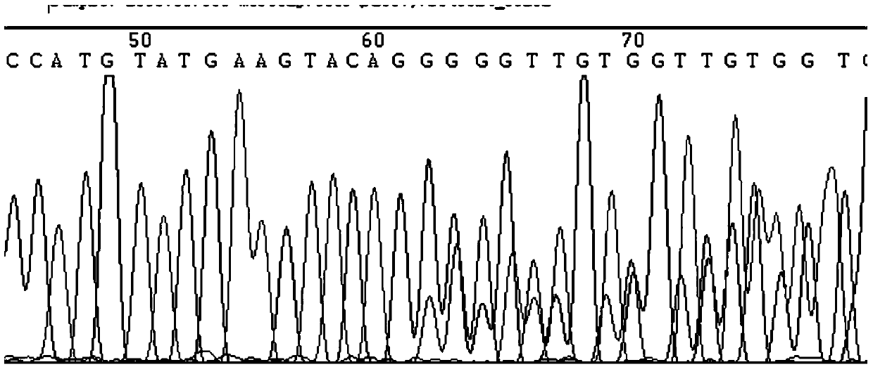 A diagnostic kit and method for detecting mutation of exon 11 of human c-kit gene