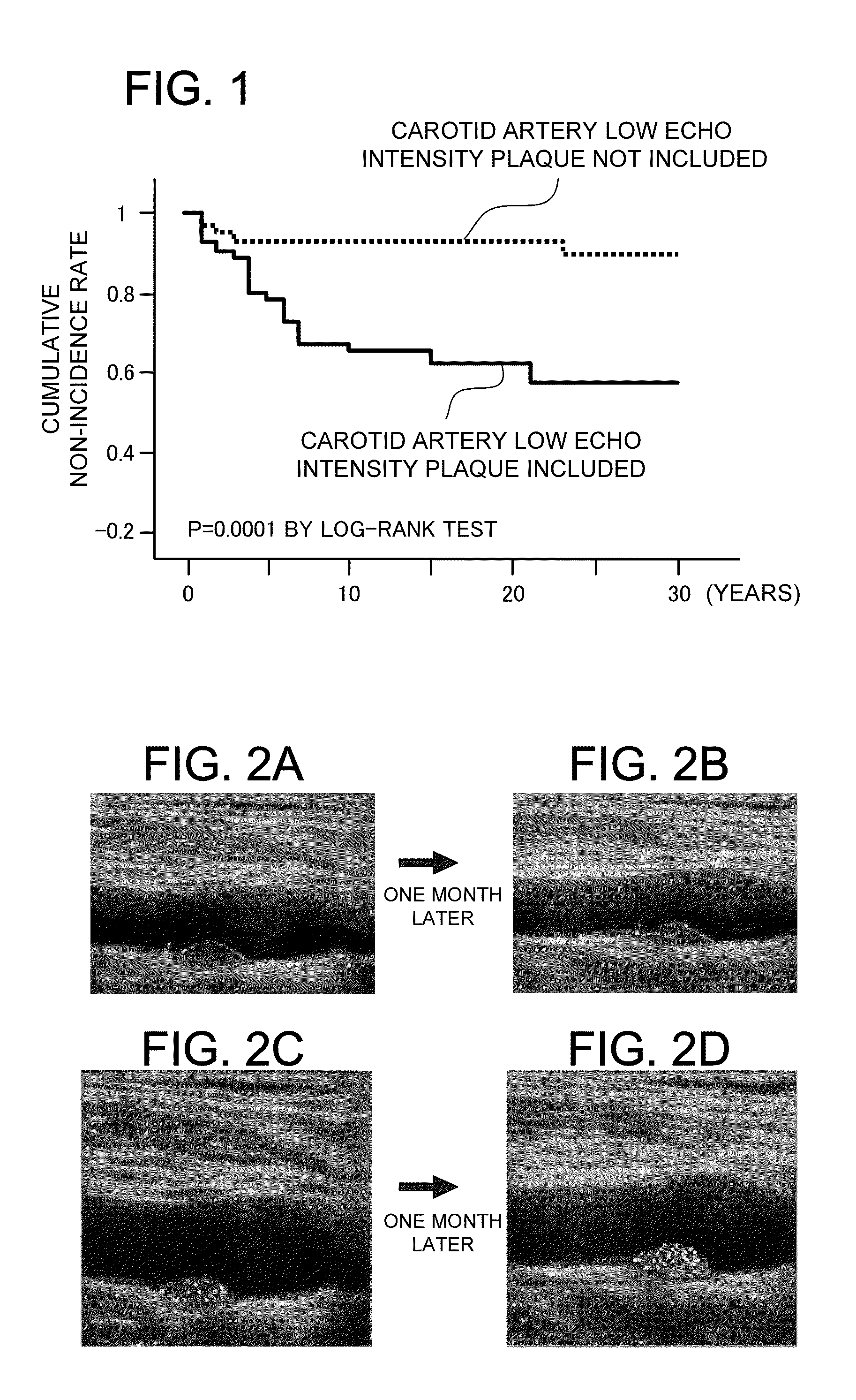 Carotid-artery-plaque ultrasound-imaging method and evaluating device