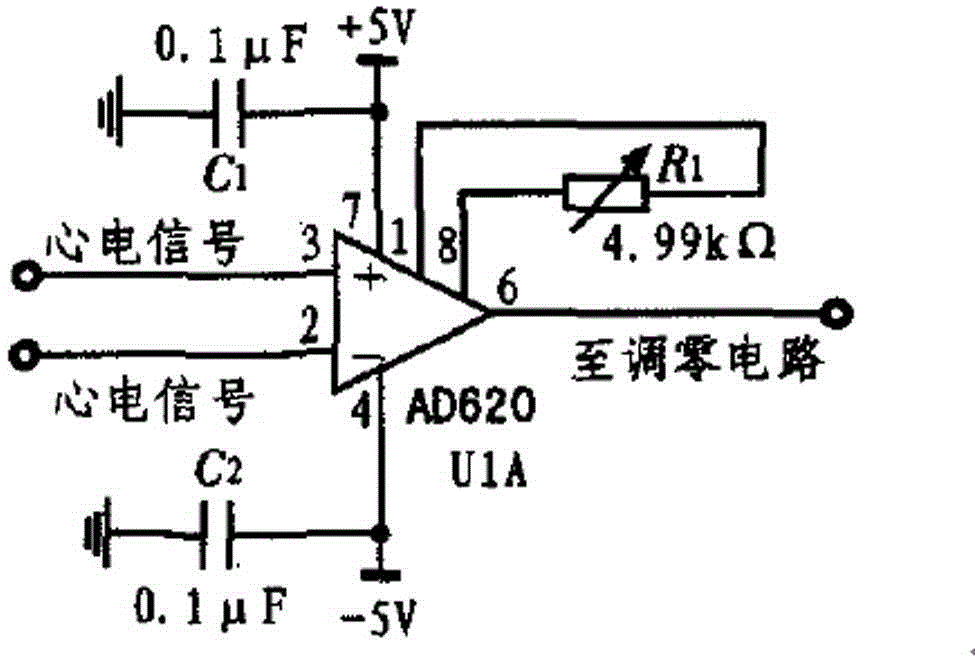 Electrocardiogram (ECG) signal conditioning circuit