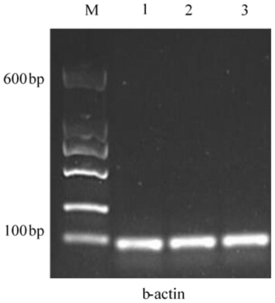 Screening method and application of meat duck real-time fluorescent quantitative PCR reference genes