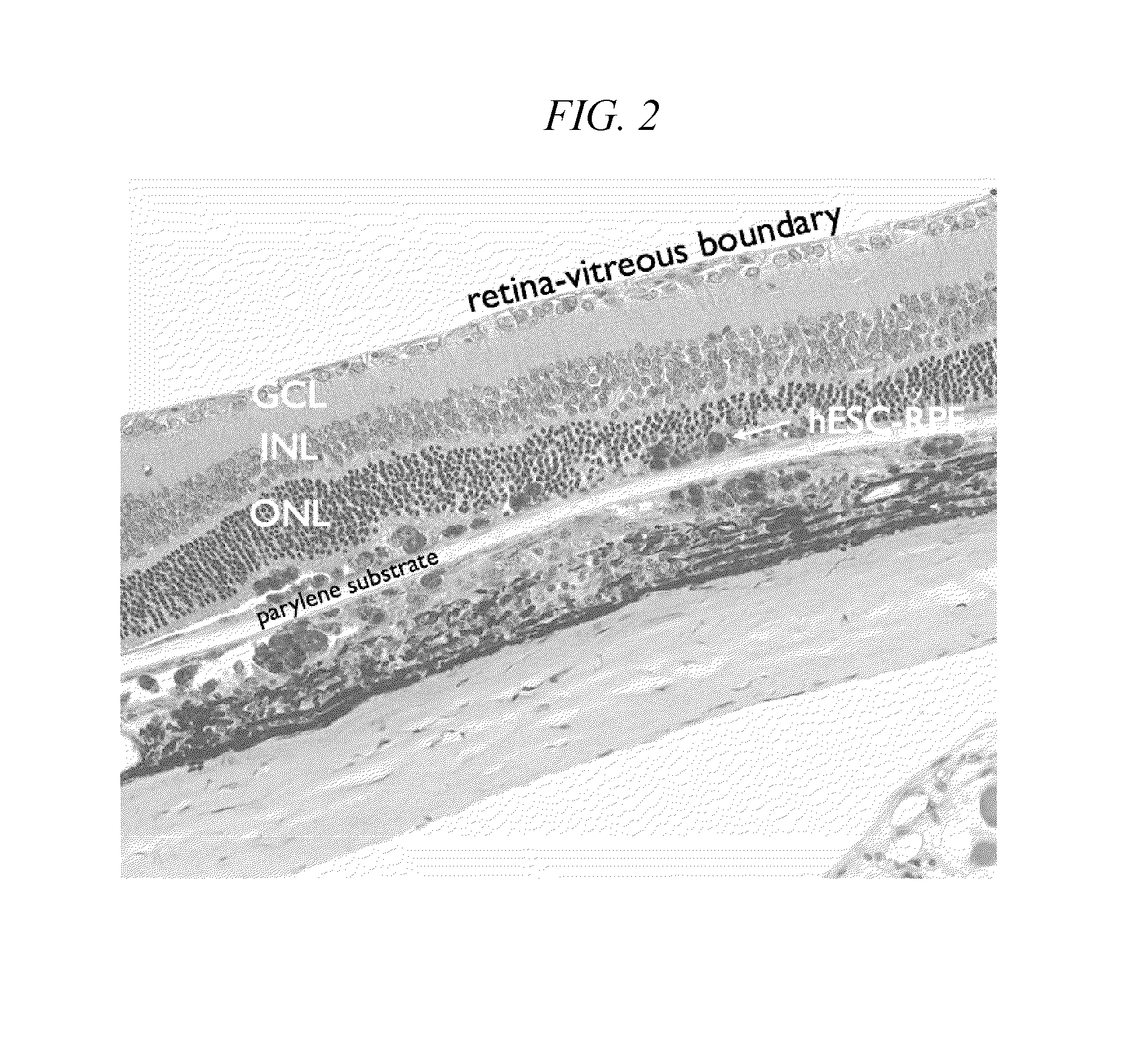Method of cryopreservation of stem cell-derived retinal pigment epithelial cells on polymeric substrate