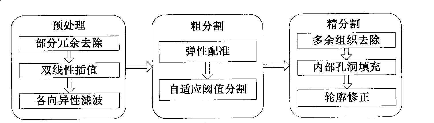Liver subsection method based on CT image and system thereof