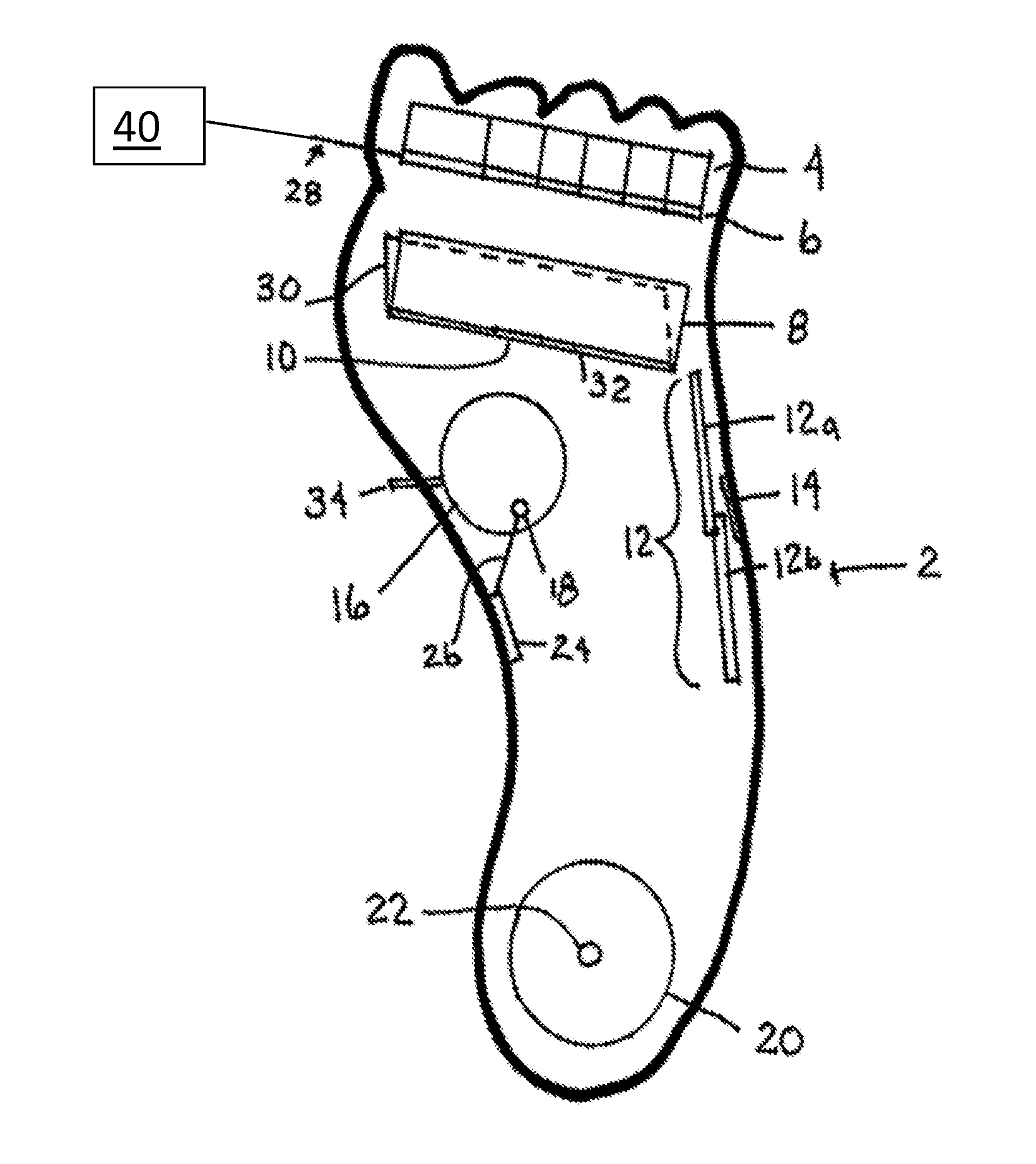 Actuated foot orthotic with sensors
