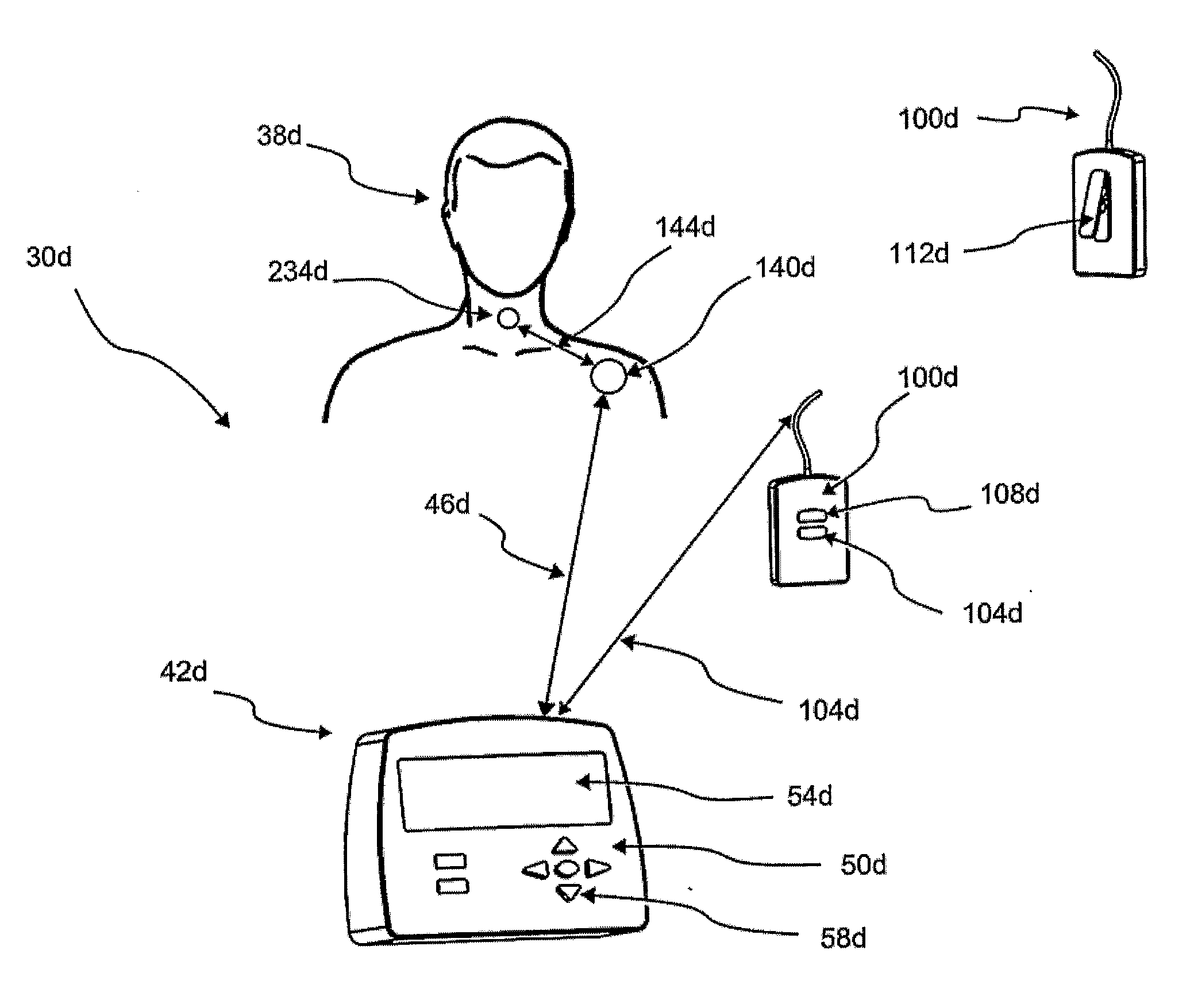 System and Method for Detecting Swallowing Activity