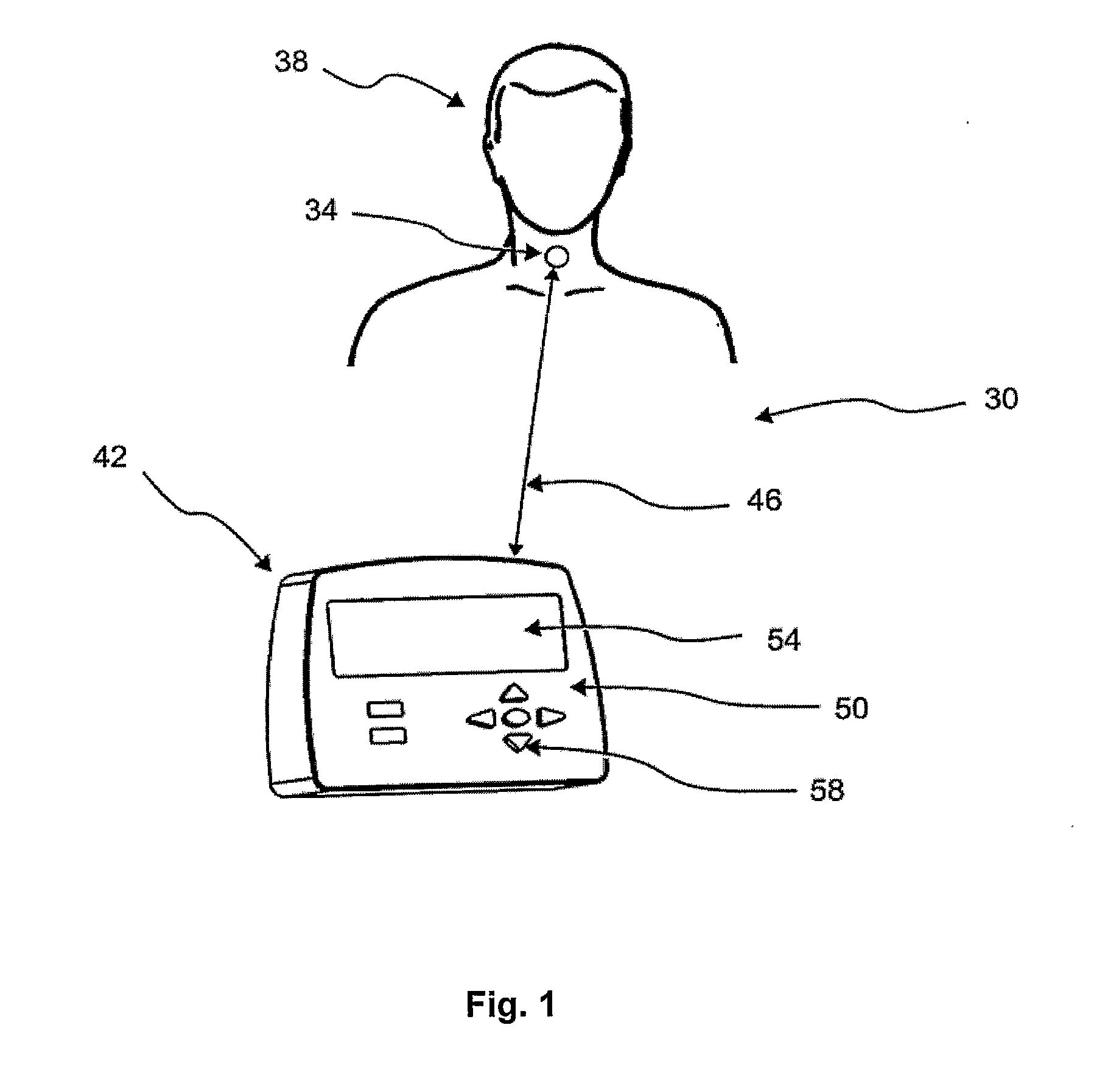System and Method for Detecting Swallowing Activity
