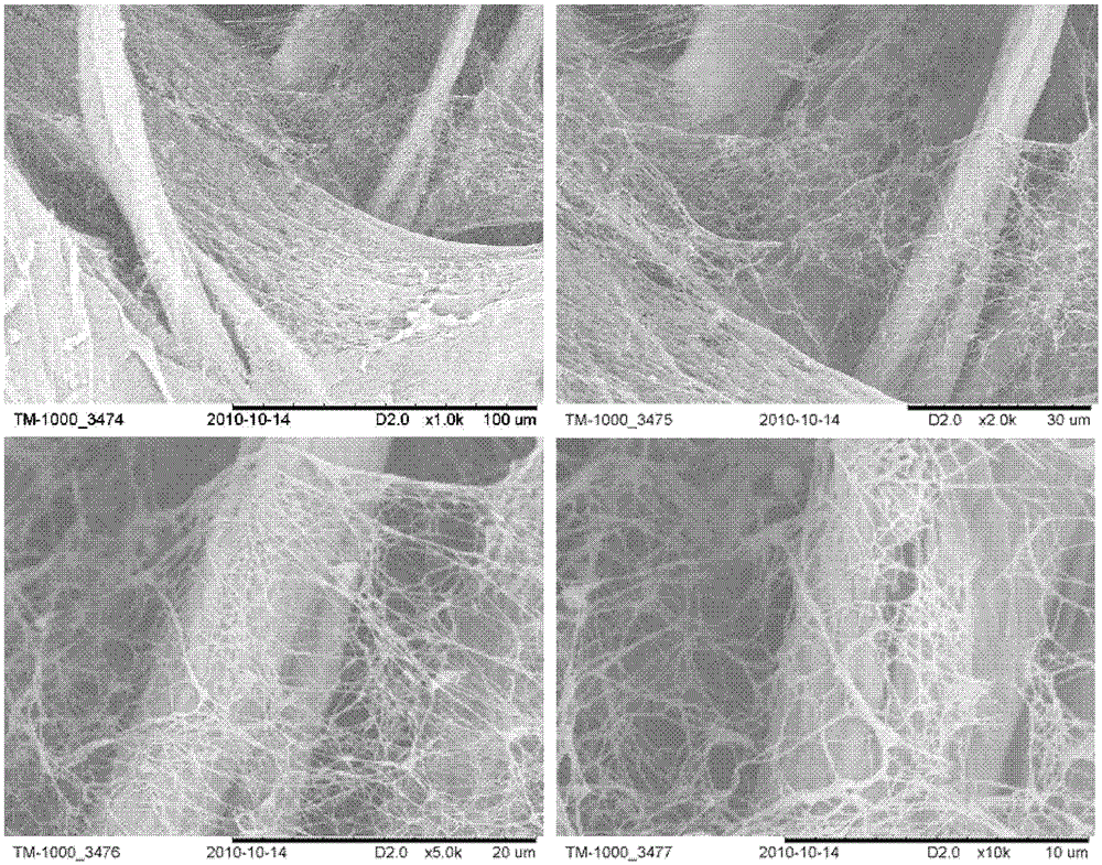 A composite structure artificial blood vessel and its dynamic preparation method