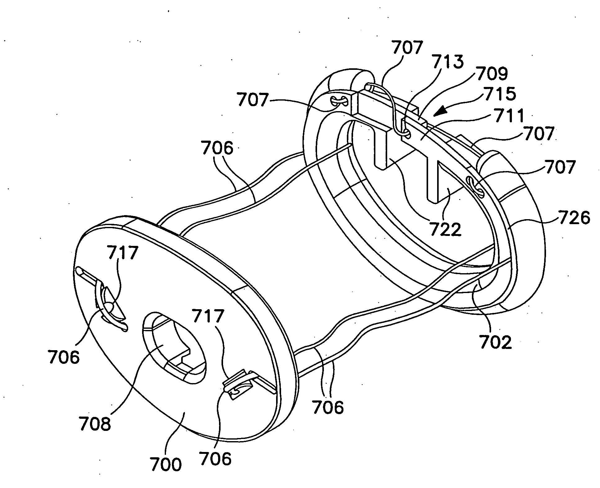 Annuloplasty system