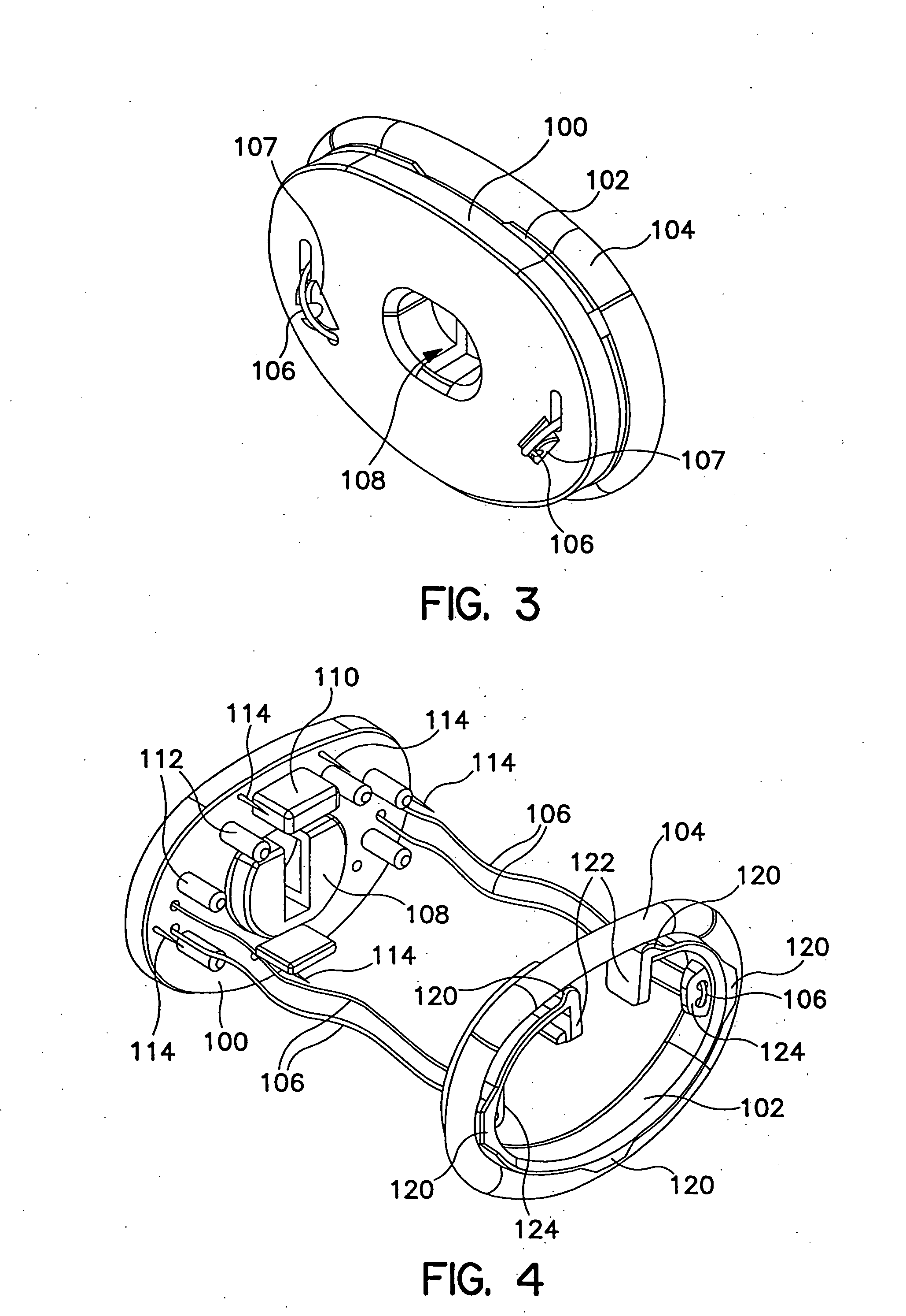 Annuloplasty system