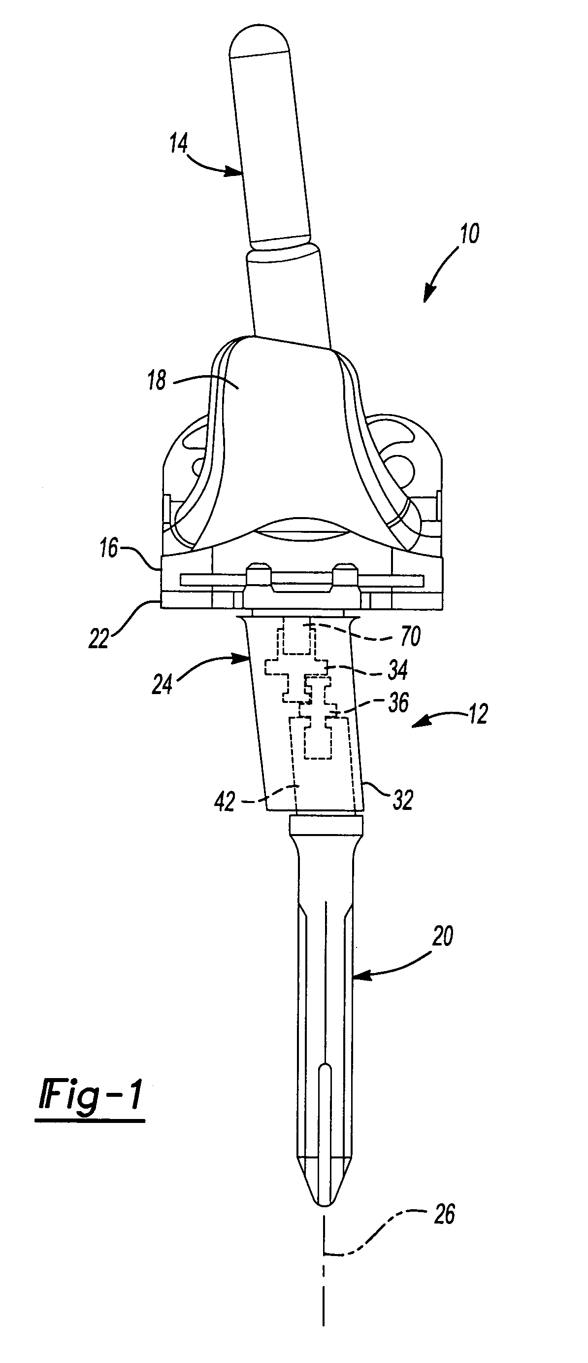 Knee joint prosthesis