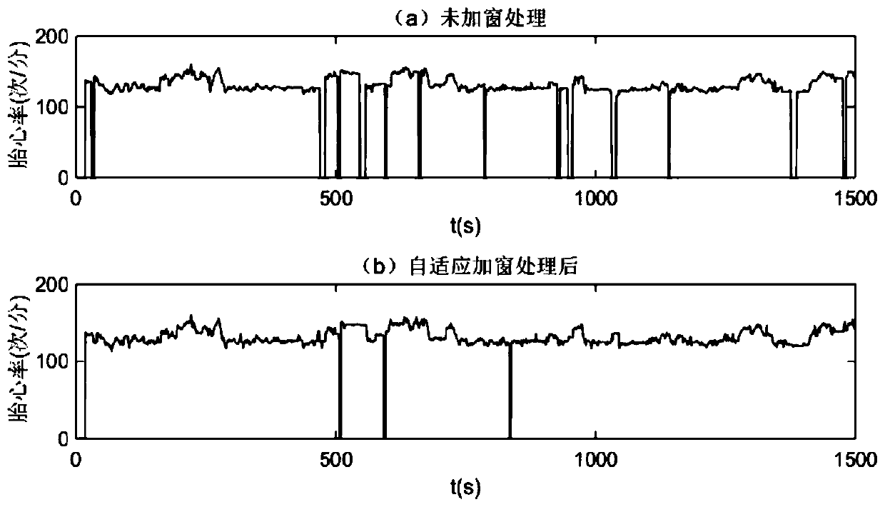 A time-domain adaptive windowing fetal heart sound noise reduction technology