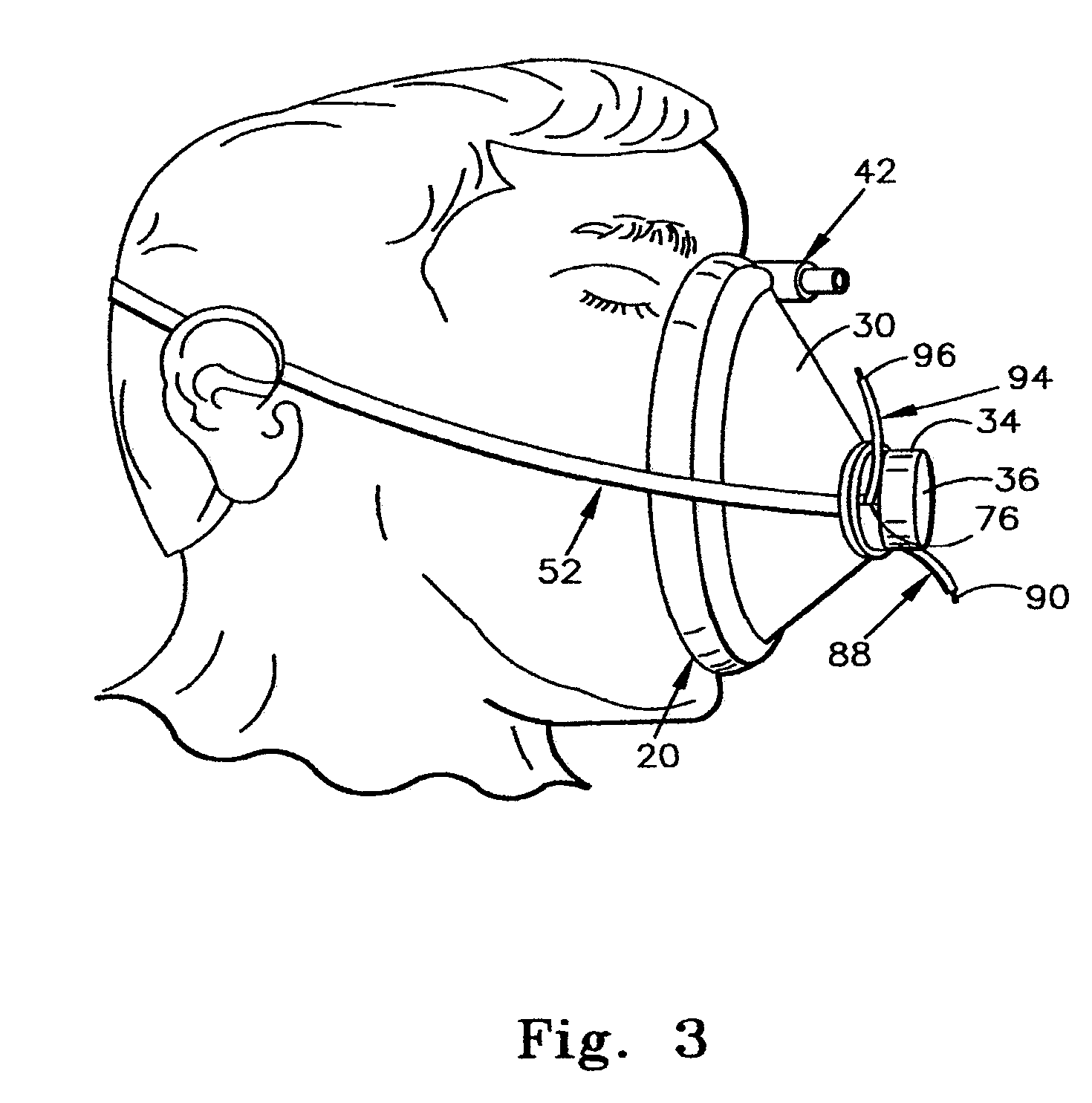 Face mask strap system