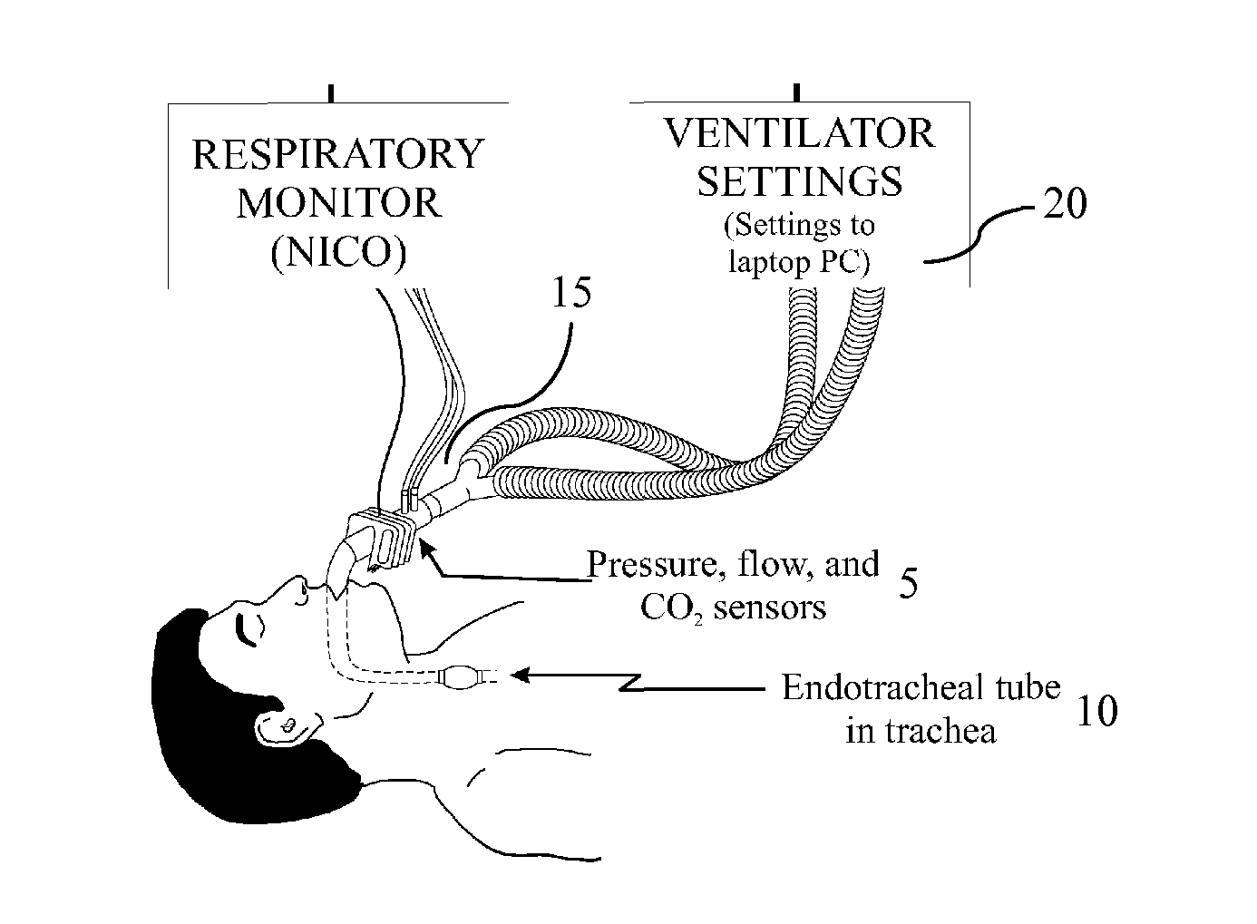 System and method for assessing real time pulmonary mechanics