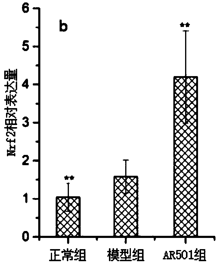 Lactobacillus plantarum reducing harms of frying oil and application of lactobacillus plantarum