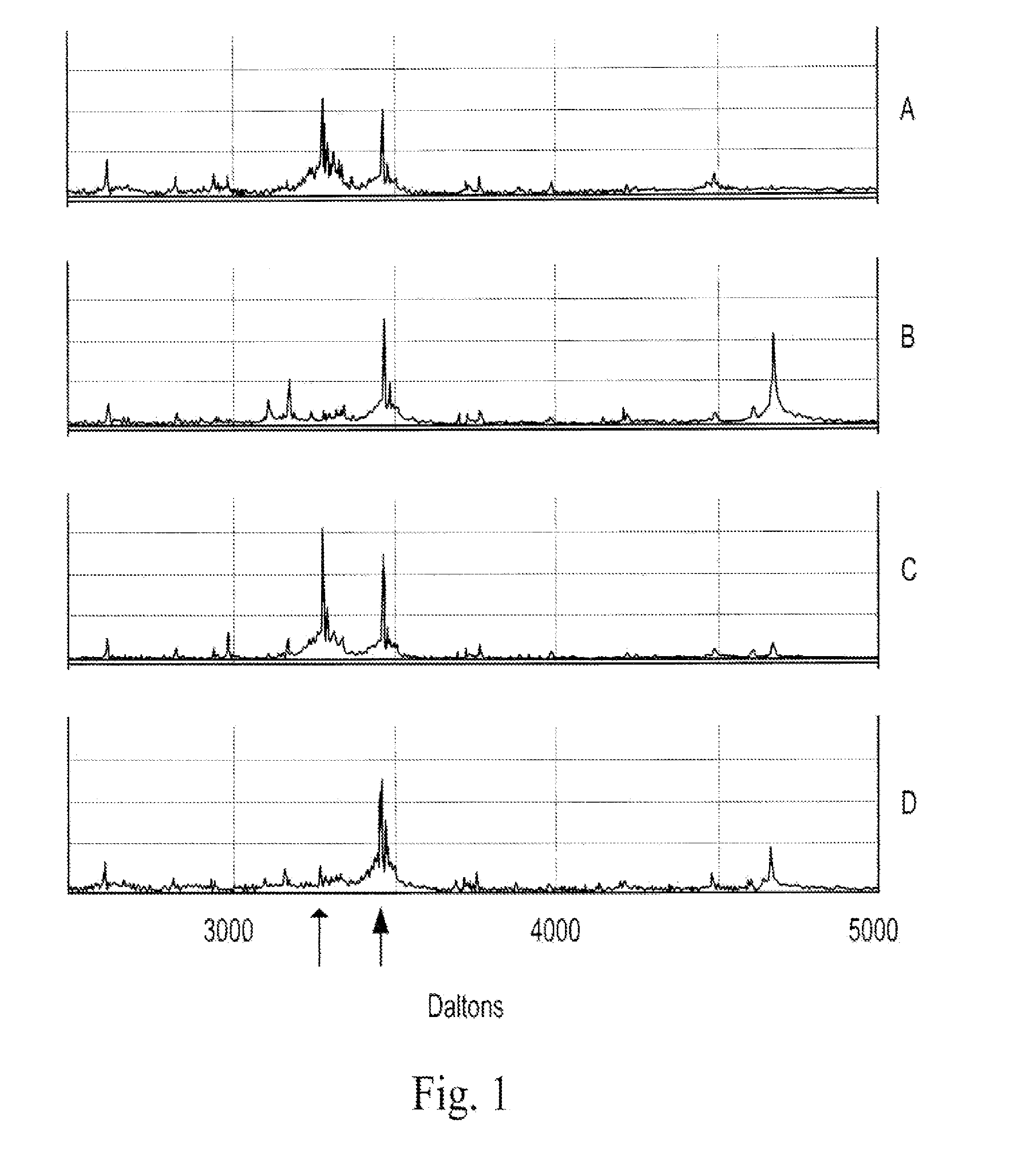 Compositions and methods for treating cardiovascular disease and myocardial infarction with dipeptidyl peptidase inhibitors or b type natriuretic peptide analogues resistant to prolyl-specific dipeptidyl degradation