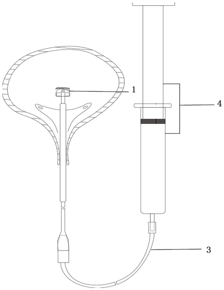 Bladder balloon implantation device