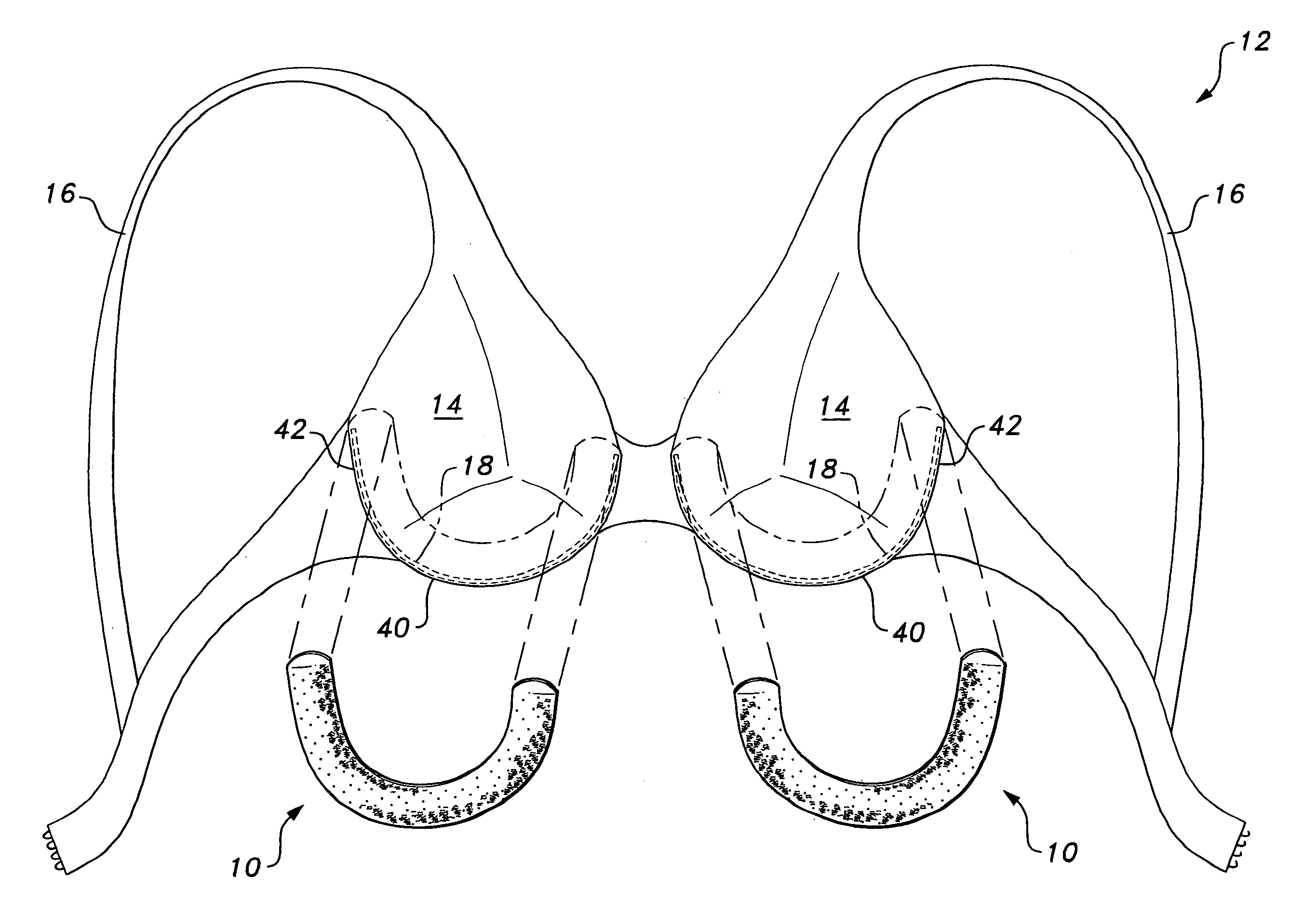 Absorbent pad for underwire brassiere