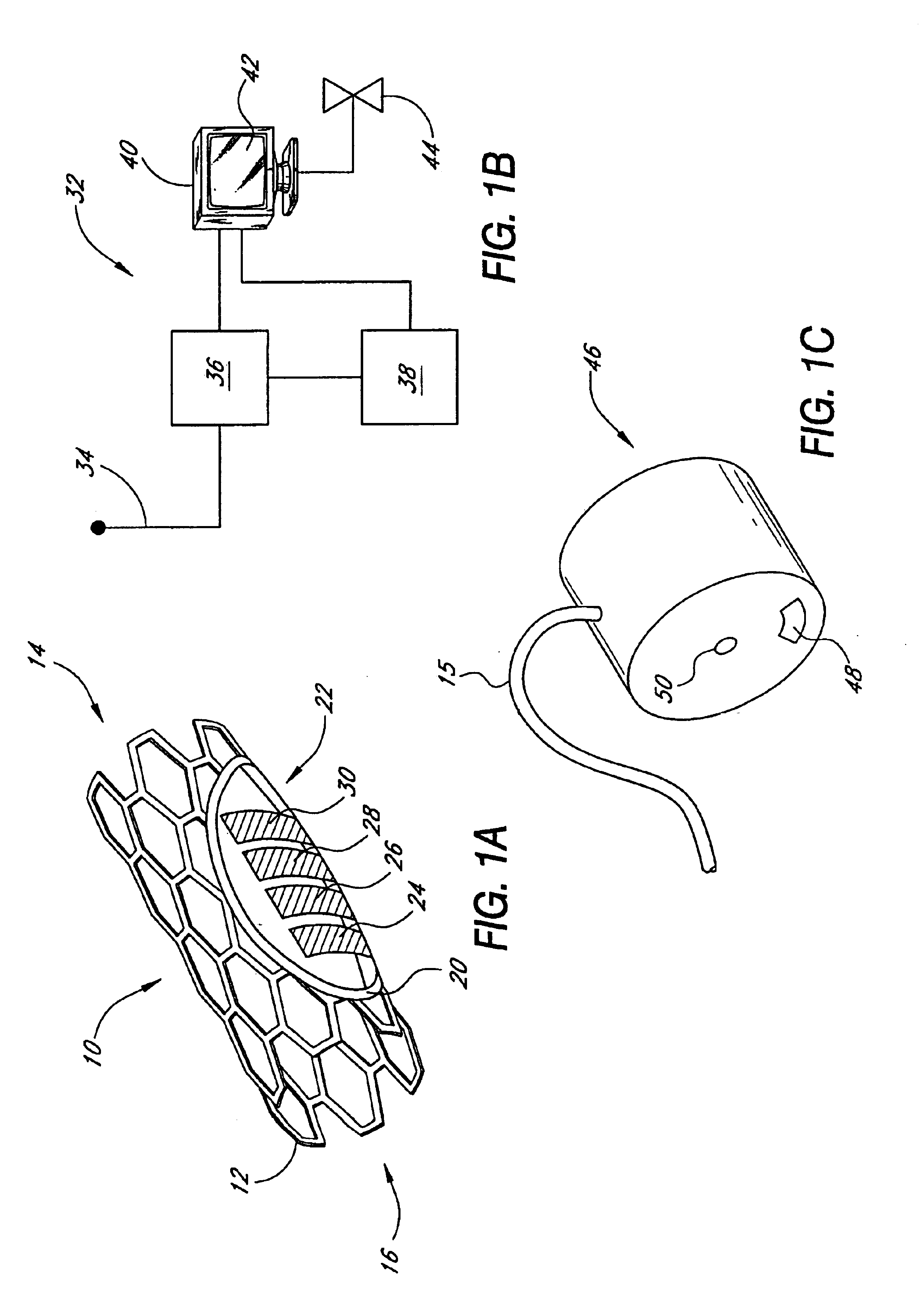 Implantable sensor
