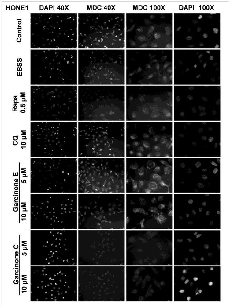 Application of Garcinone E in preparation of tumor cell autophagosome inducer