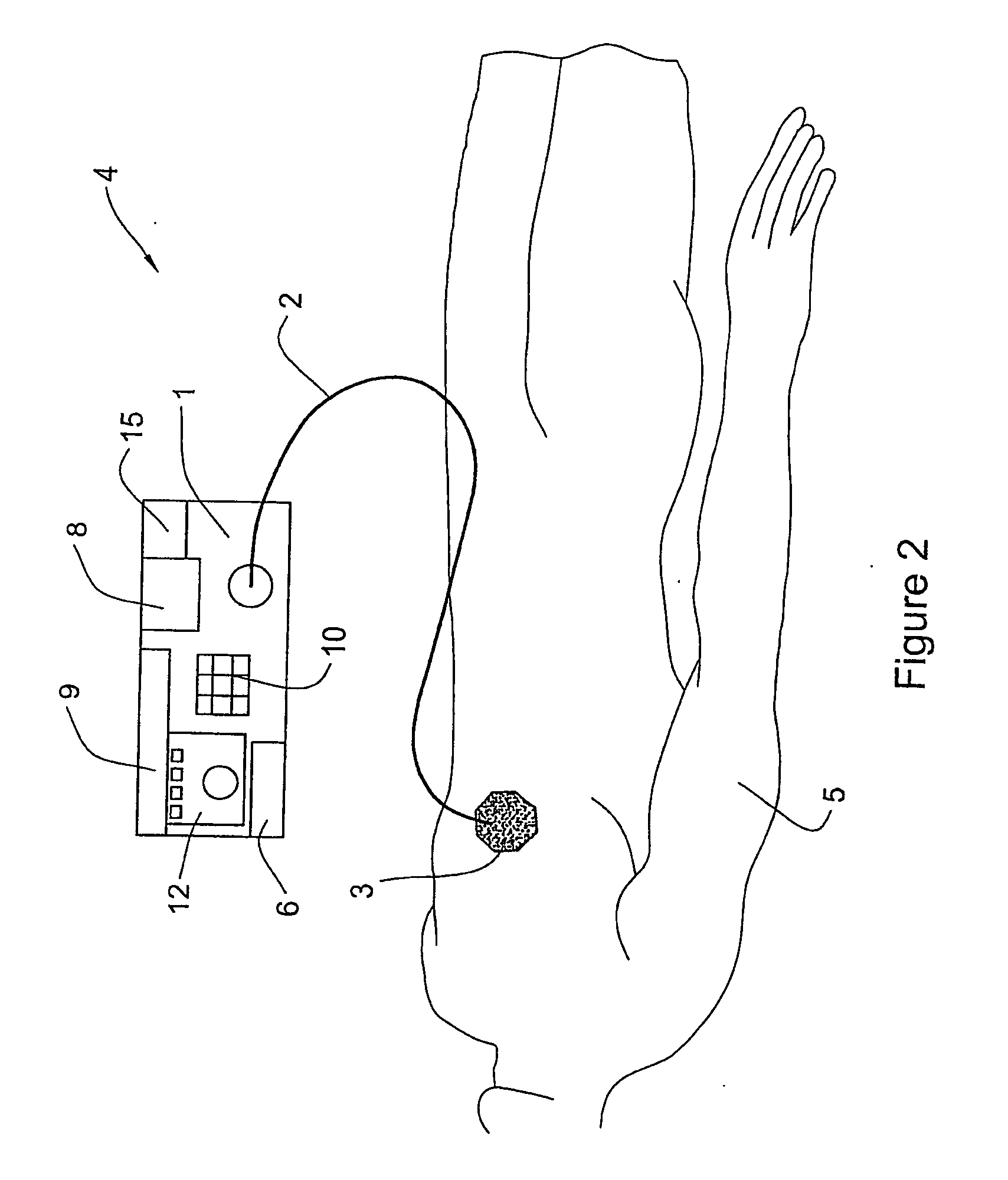 Method and Apparatus for Treatment of Adipose Tissue