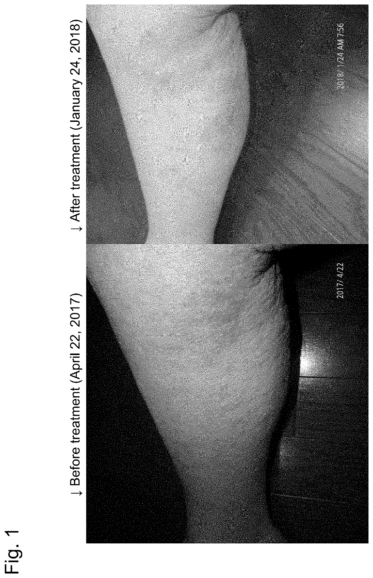 Method for reducing itching in atopic dermatitis