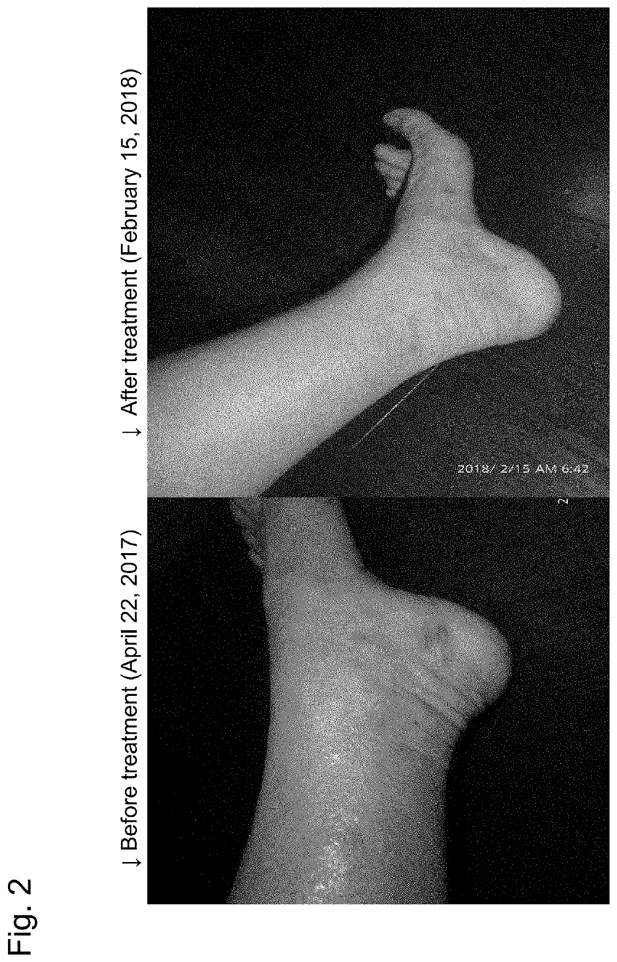 Method for reducing itching in atopic dermatitis