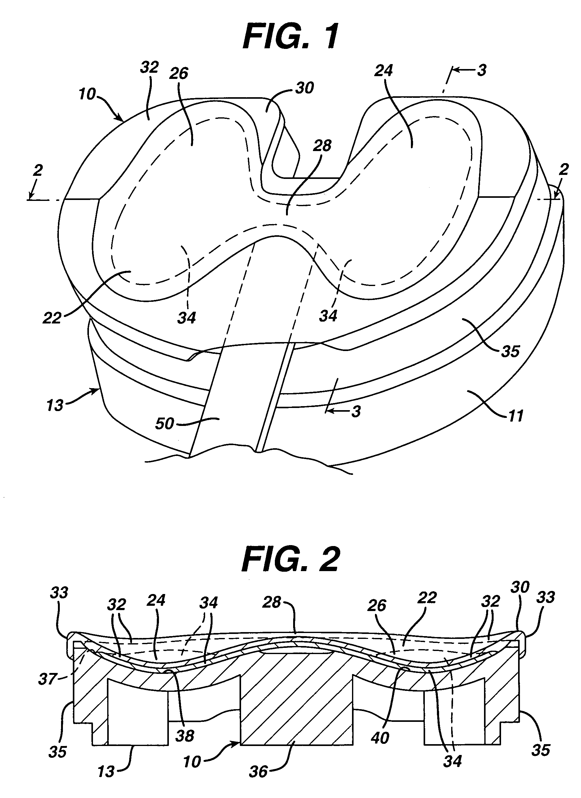 Apparatus, system and method for intraoperative performance analysis during joint arthroplasty