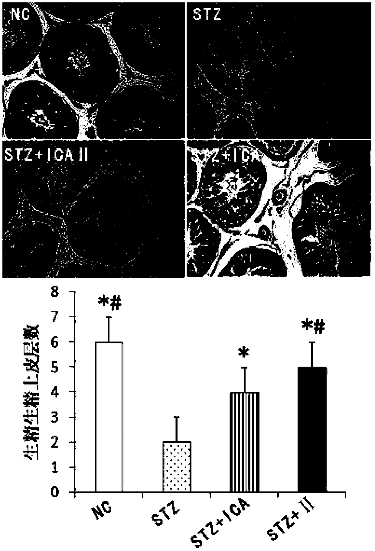 Use of icariside Ⅱ in the preparation of products for preventing and treating reproductive dysfunction