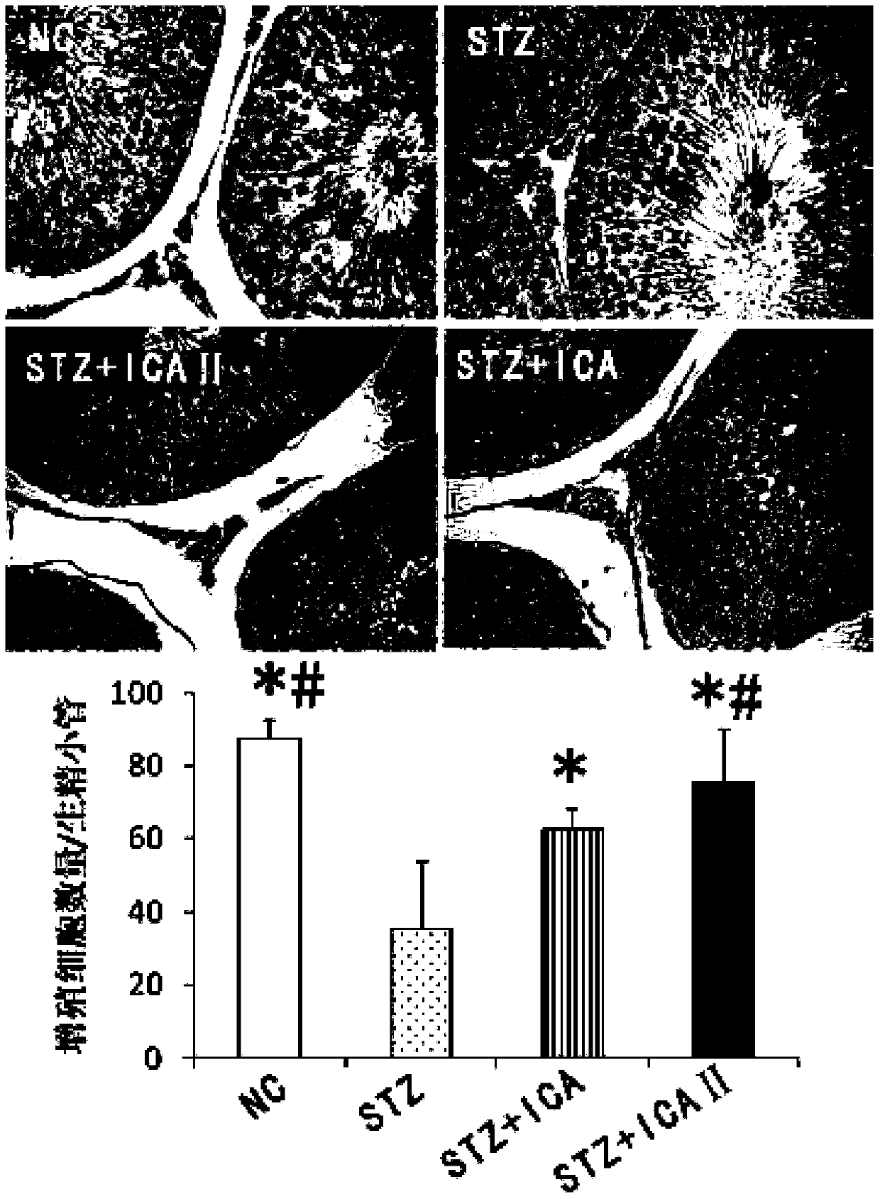 Use of icariside Ⅱ in the preparation of products for preventing and treating reproductive dysfunction