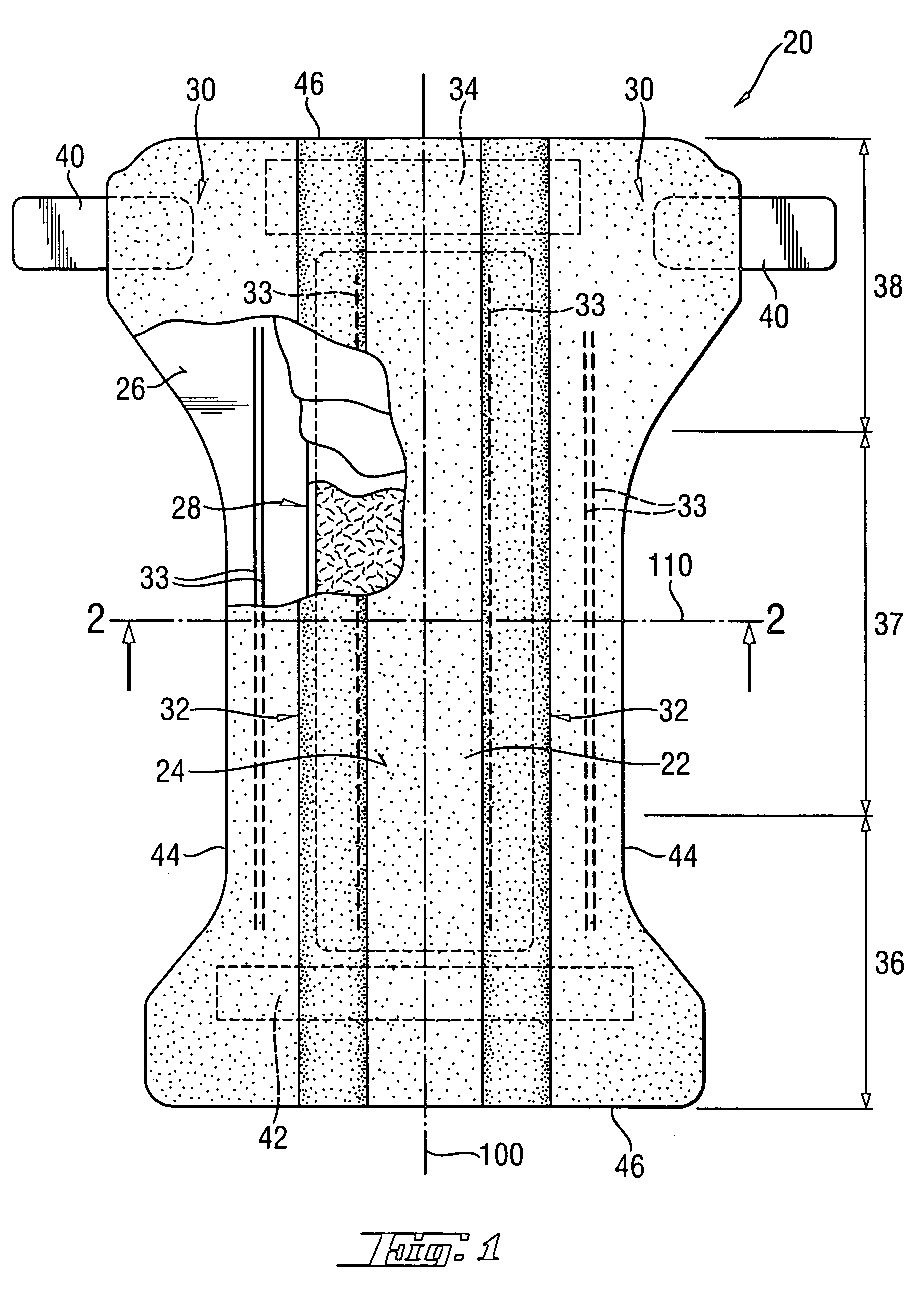 Surface cross-linked superabsorbent polymer particles and methods of making them