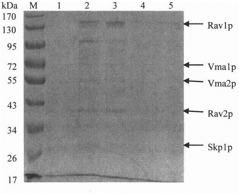 Method for separating RAVE compound from Saccharomyces cerevisiae cells by using FLAG label