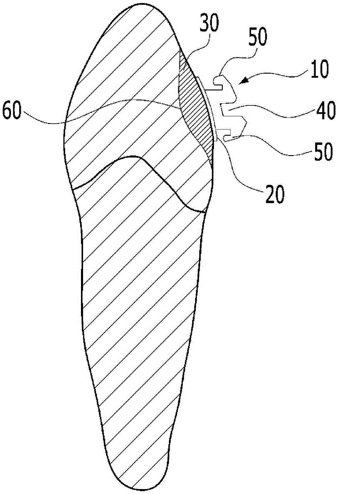 Individually tailored lingual orthodontic bracket and method for manufacturing same bracket