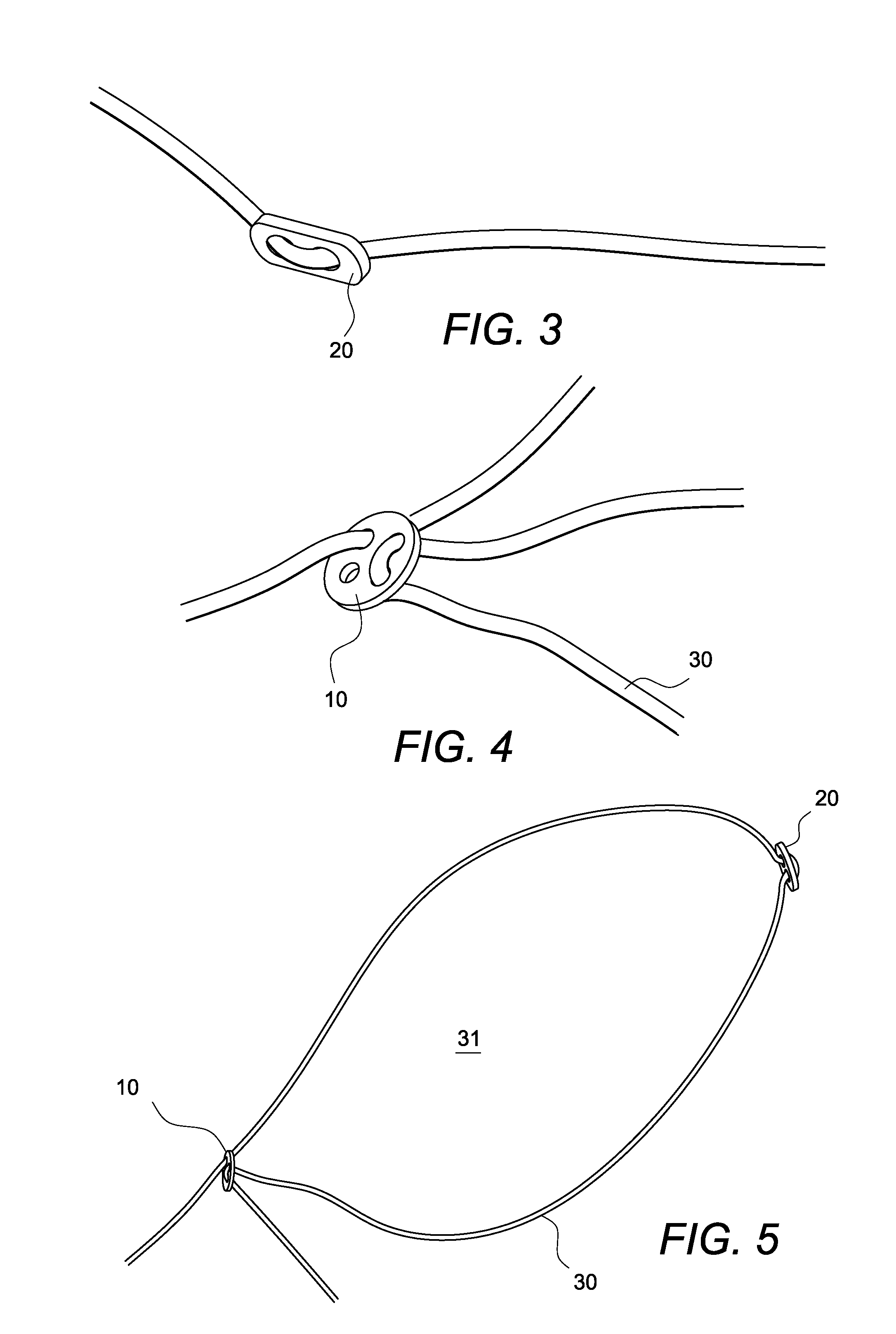 Adjustable suture-button construct for ankle syndesmosis repair