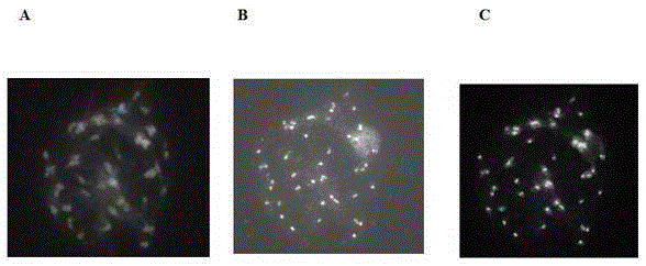Pineapple function centromere antigenic polypeptide and application thereof